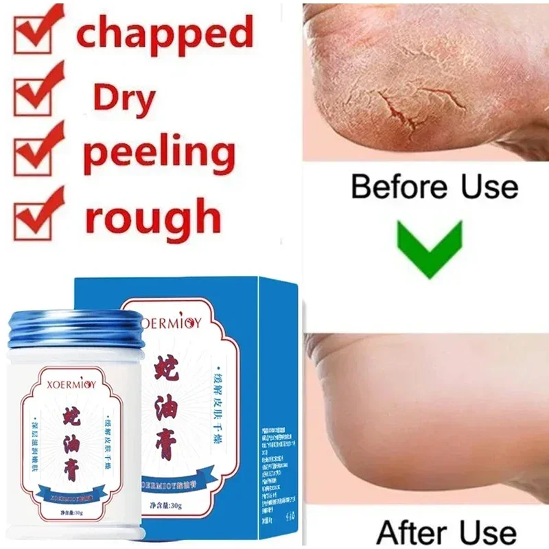 Herbal Anti Crack Foot Cream Heel Cracking Repair Products Exfoliation Dead Skin Removal Softening Moisturize Smooth Skin Care