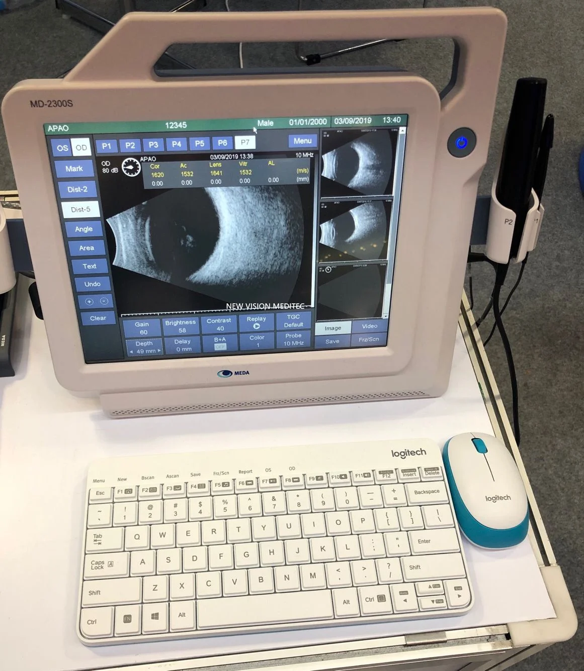 MD-2300S Ultraschall-AB-Scan Ultraschall-AB-Scanner für die Augenheilkunde