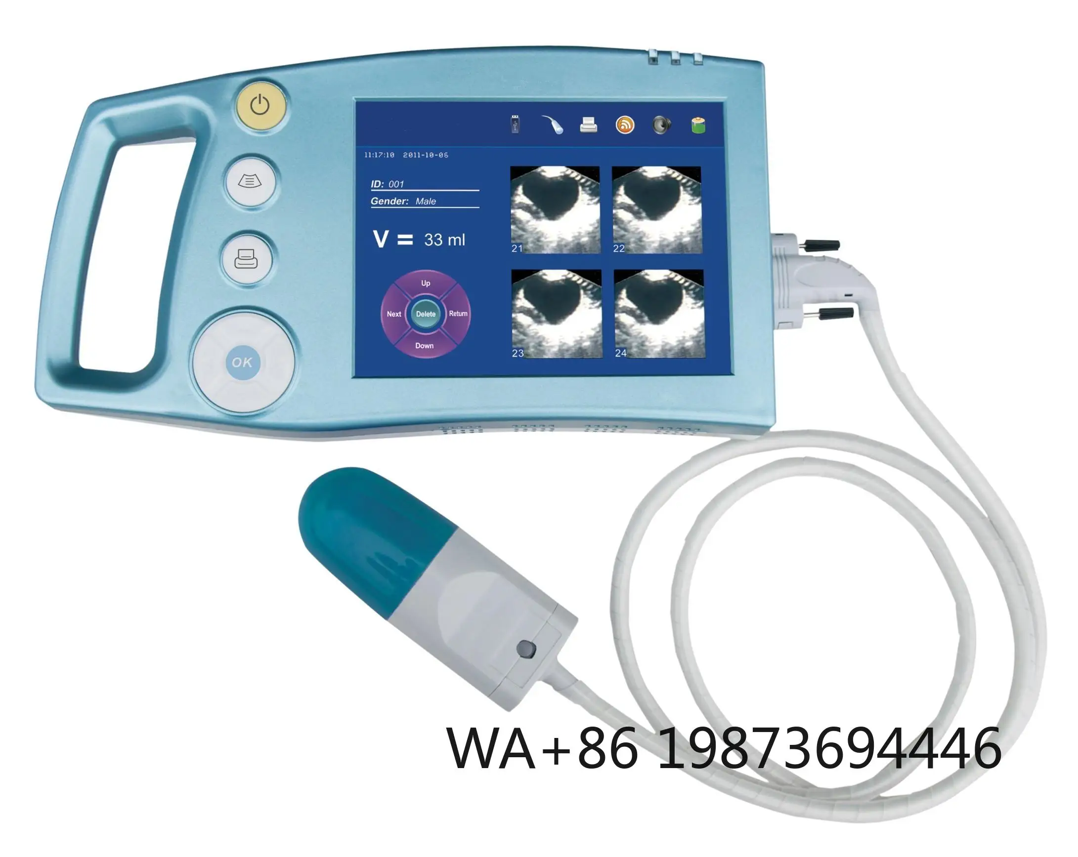 Portable Medical Bladder Scanner, compact diagnostic device for clinical bladder measurement examination