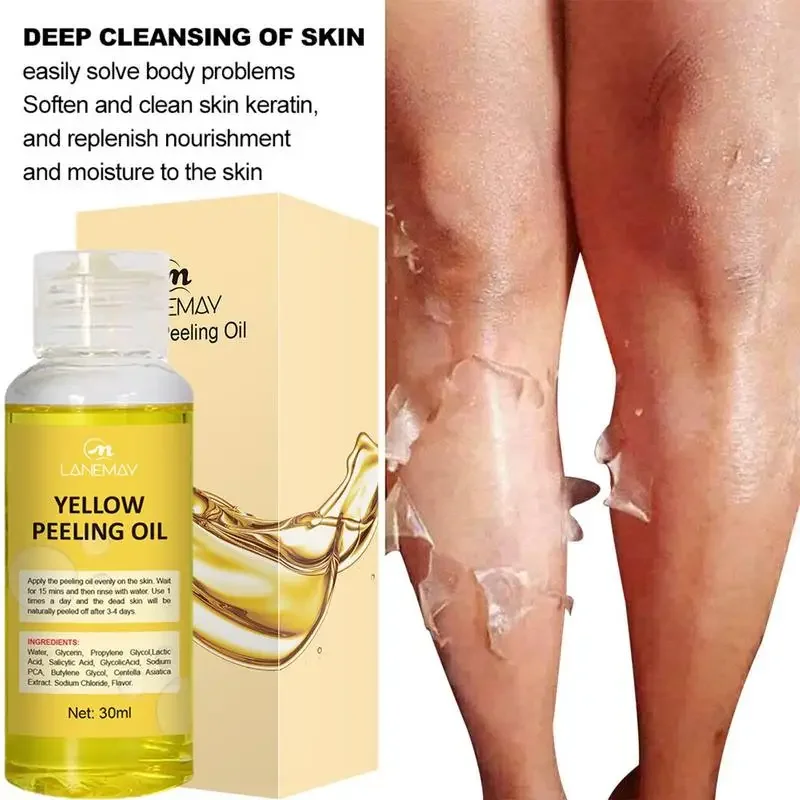 Yellow Peeling Oil Strong Yellow Peeling Oil Lighten Elbows Knees Hands Melanin Even Skin Tone And Whiten Skin