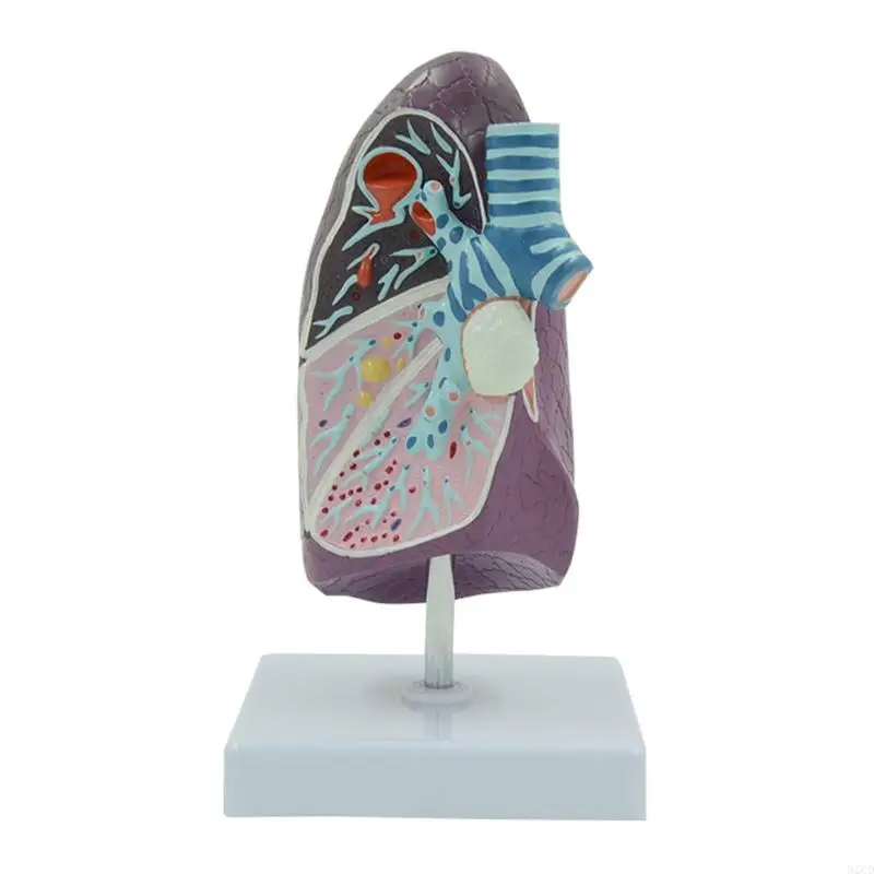 

2025 New Anatomical Pathological Lung Model for Pulmonary Study Medical Lecture Education Use Shows Lung