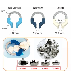Dental Matrix Bands Sectional Contoured NITI Metal Matrices Clamp Ring Elasticiry Matrix Strips Dentist Tool