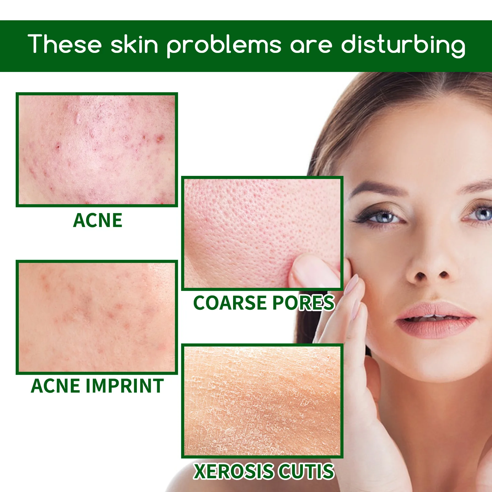 살리실산 안티 여드름 페이스 세럼 하이드레이팅 페이더 여드름 마크 여드름 블랙헤드 제거 수축 모공 오일 컨트롤 페이셜 에센스