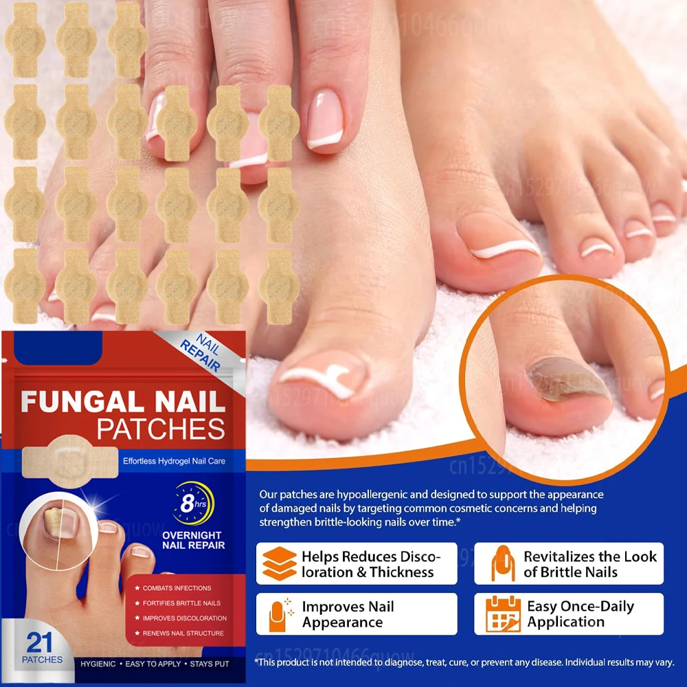 

Пластыри для ремонта ногтей, ночное лечение, коррекция внешнего вида, улучшение ногтей, поврежденный обесцвеченный пластырь на грибке ногтей на ногах