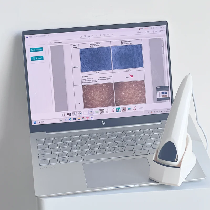 Multi Language Cosmetics Chains Products Facial  Products Recommendation Report Face Scanner  Analysis Machine