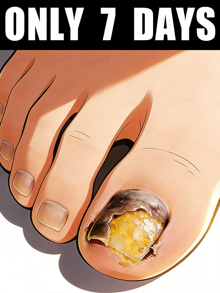 

Нежное и не раздражающее средство, устраняет проблемы с ногтями, вызванные грибком!