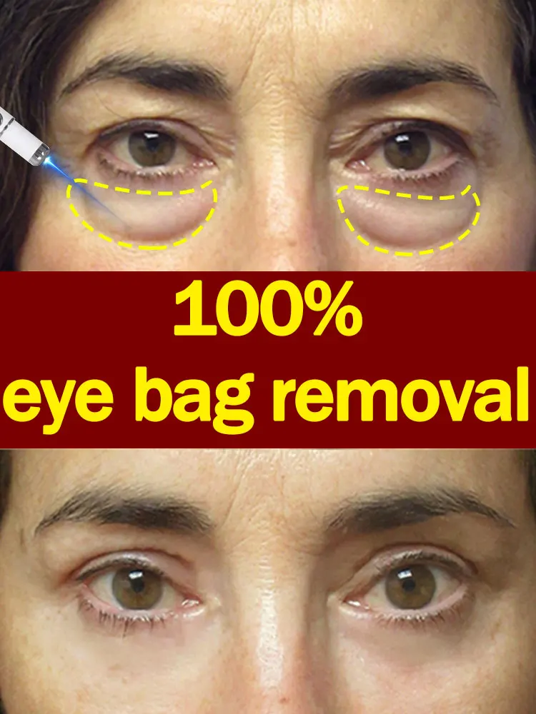 Eliminates under-eye bags, unisex