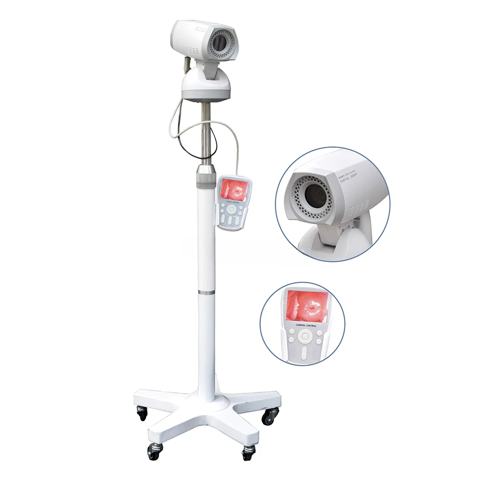 For LH9800A Mobile Examination Obstetrics Gynecology Video Gynecological Obstetric Machine for Woman Colposcopy Equipment