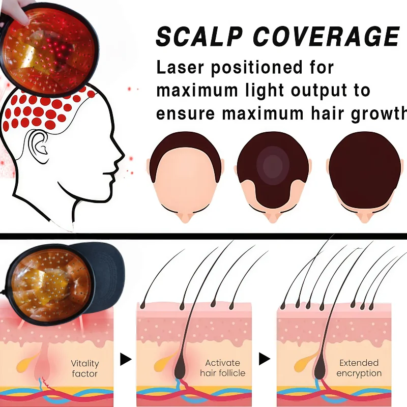 

Professional 650nm LLLT Laser Cap for Hair Loss Treatment and Regrowth - Red Light Therapy Hat for Thinning Hair