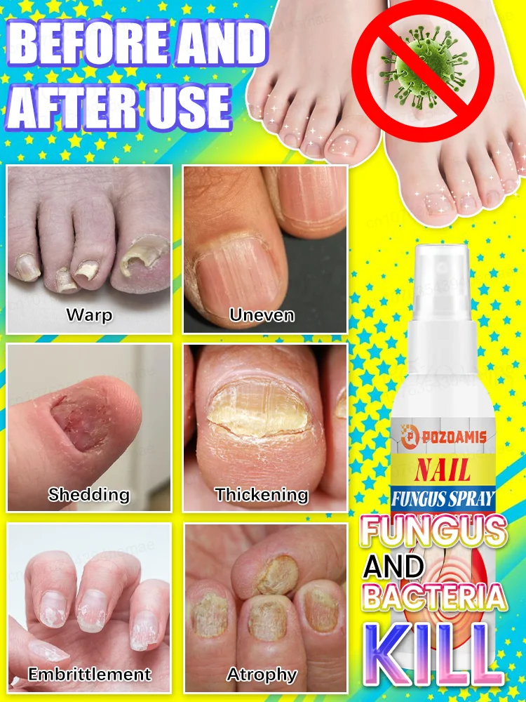 This nail spray can not only remove bacteria and gray nails, ᵇᵘᵗ ᵃˡˢᵒ ᶠᵒʳᵐ ᵃ ᵖʳᵒᵗᵉᶜᵗⁱᵛᵉ ˡᵃʸᵉʳ