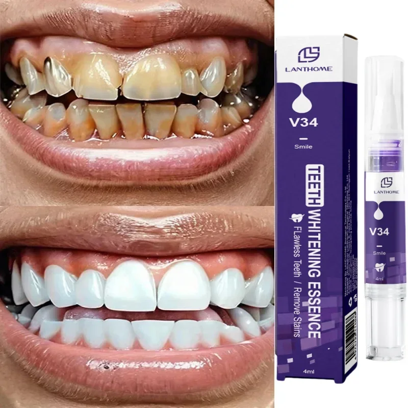 

V34 Teeth Whtening Toothpaste Pen Remove Plaque Stains Cleaning Oral Hygiene Bleaching Dental Tools Fresh Breath Tooth Care