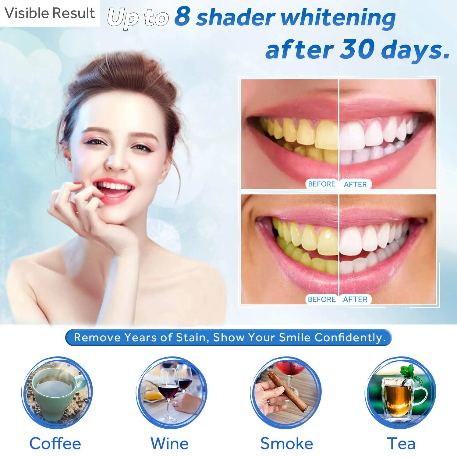 Teeth Whitening Gel Refill Syringe Tooth Bleaching Gel Bleach For Invisalign Style Tray Dental Grade Tooth Whitener White Kit
