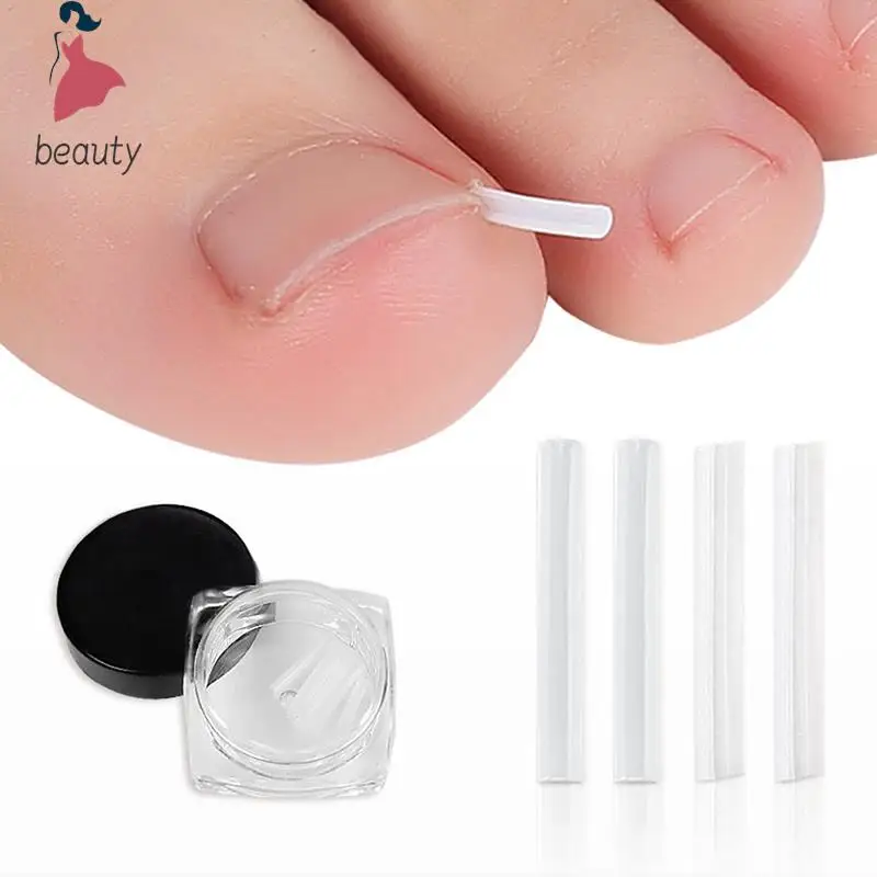 Herramienta de corrección de uñas encarnadas, tratamiento de parche adhesivo para uñas encarnadas, Clip Alisador, herramienta de pedicura, 10/20/30/50 piezas