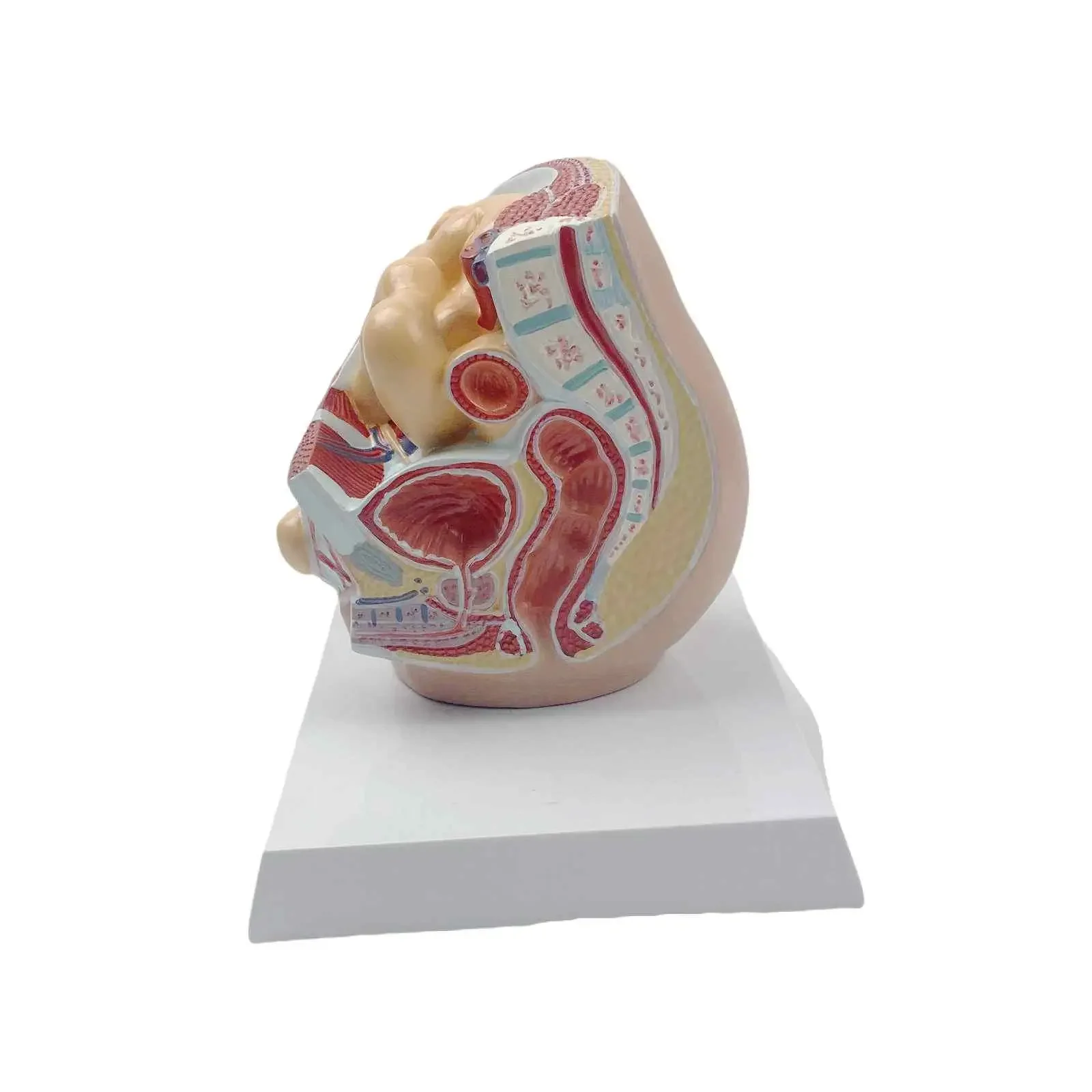 Human Oblique Inguinal Hernia Pathological Skin Model Medical School