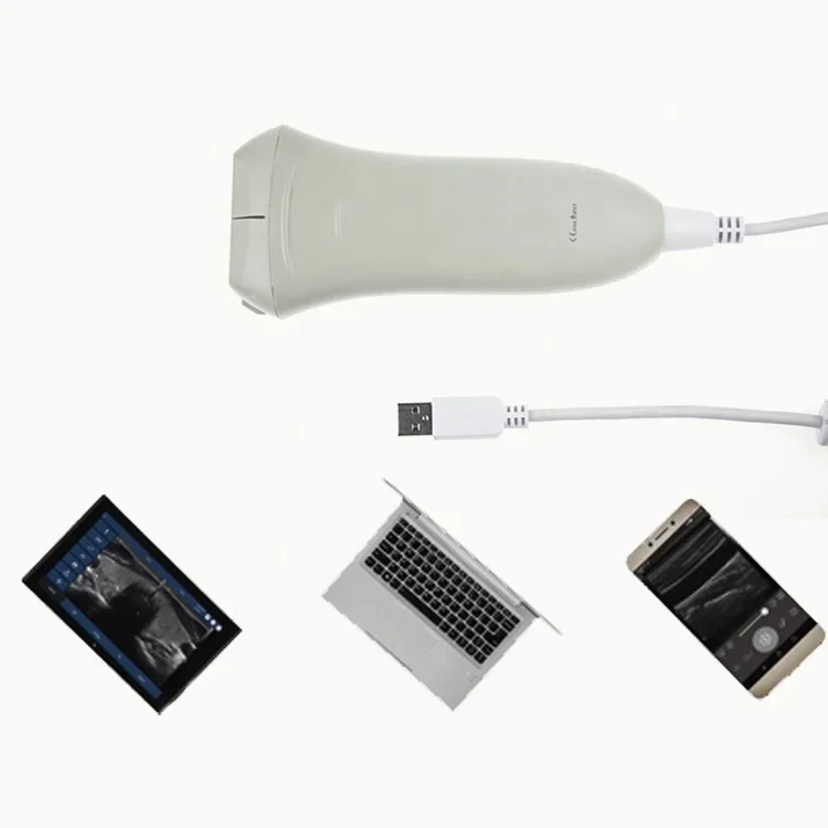 HD Image 7.5MHZ Digital Handheld Probe type Ultrasound Scanner