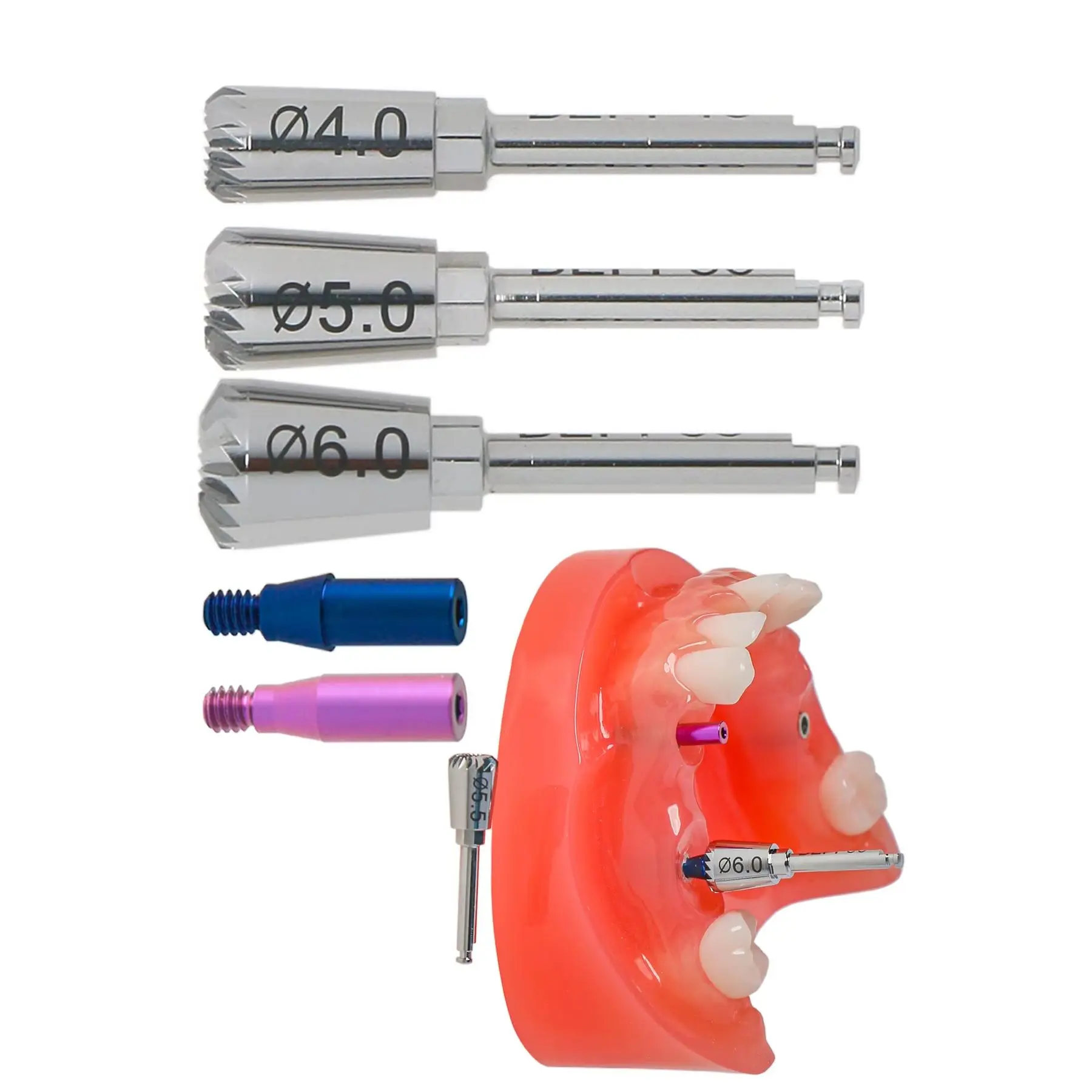 

Dental Implant ET Bone Profiler 4.0+5.0+6.0 & Guide Screws Mini Regular fit Hiossen for Dentist