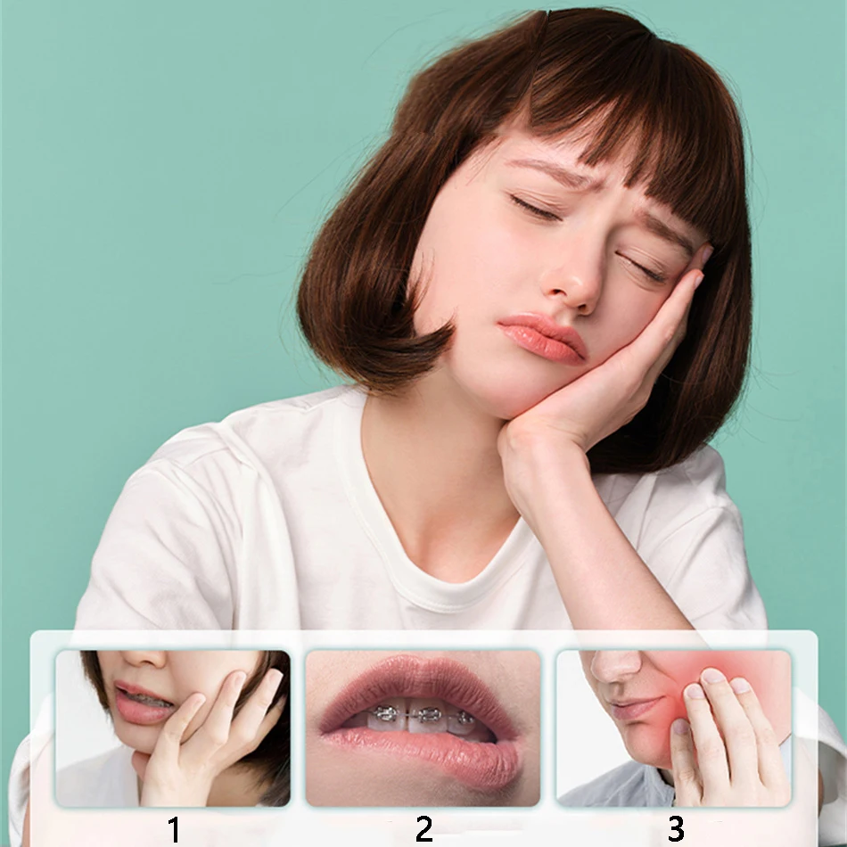 Orthodontic Mouth Guard Gel Protect Against Mucosal Damage Caused By Oral Treatment Accessories Such As Brackets And Bone Screws