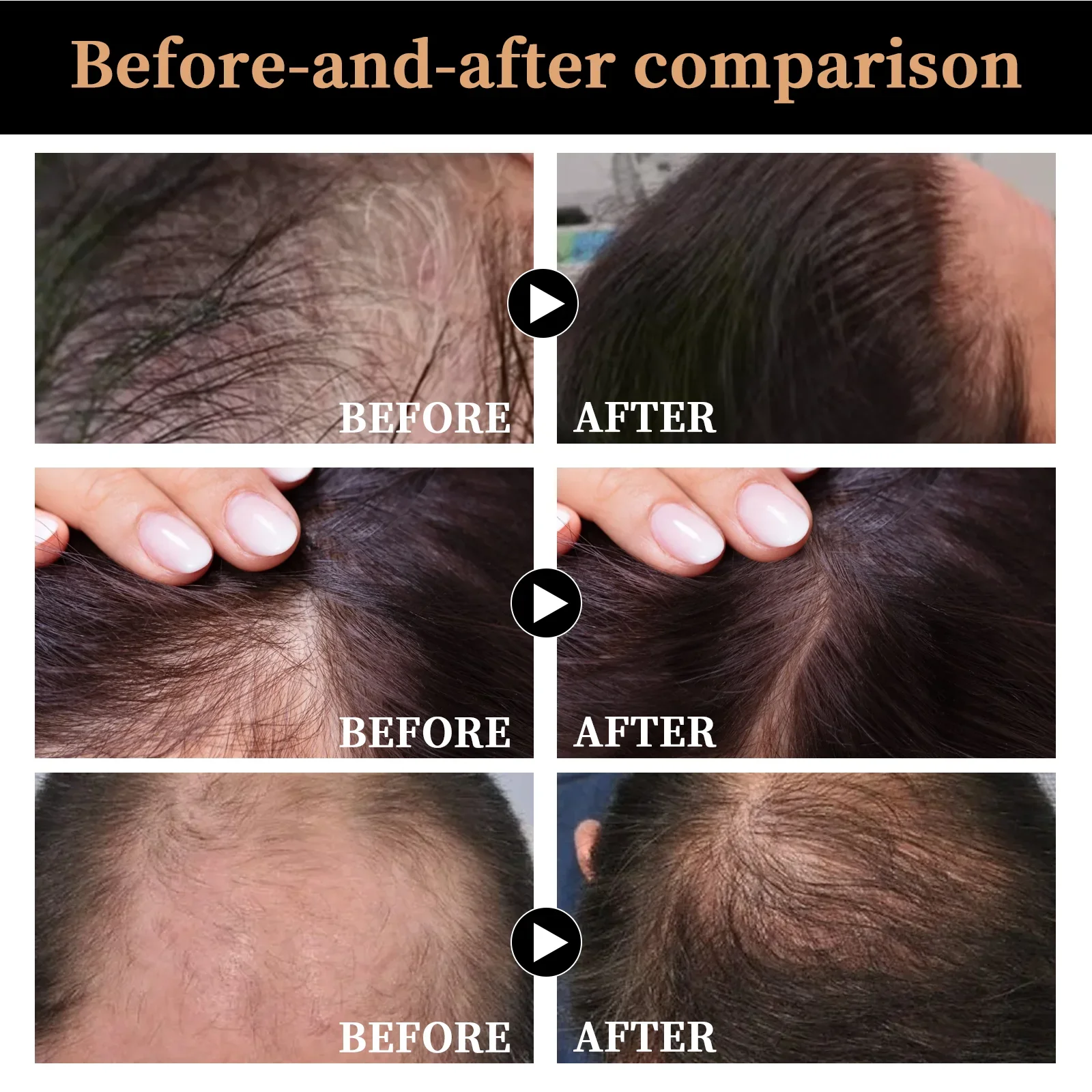 شامبو إعادة نمو الشعر شامبو سماكة الجذر المنشط شامبو رقيق تغذي العناية لتخفيف الشعر شامبو مضاد لتساقط الشعر #3