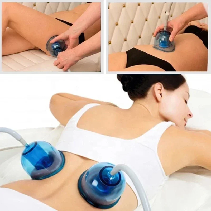 Starvac Vacuüm Cavitatie Roller Zuignap Borst Therapie Billen Afslanken Gewichtsverlies Massage Machine