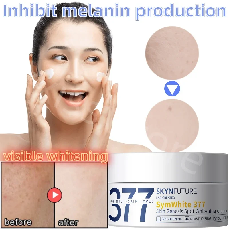 SKIN FUTURE 377 High Efficiency Whitening and Freckle Removing Cream Lighten Spots and Brighten Skin Moisturizing Cream 30g