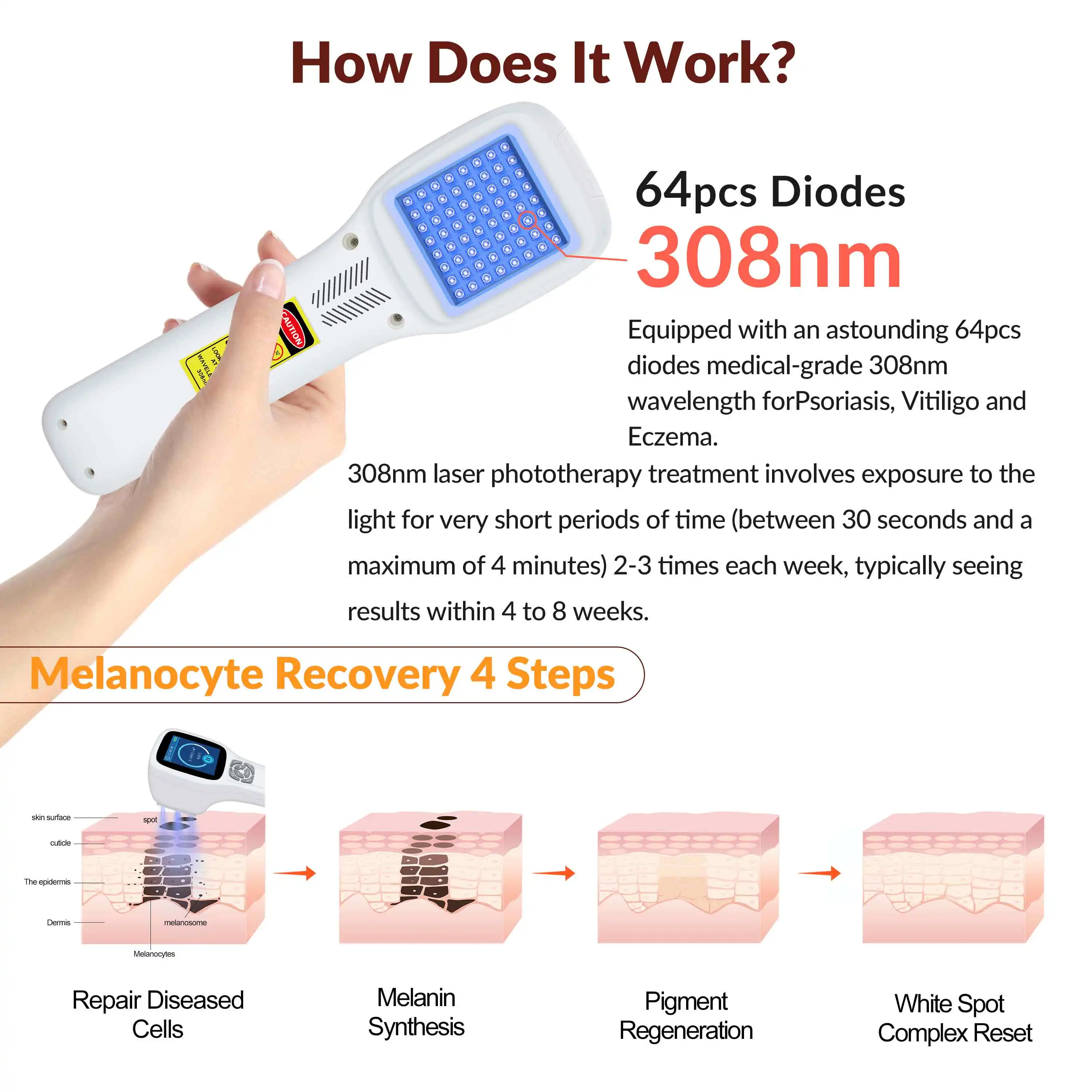 ZJZK Vitiligo Handheld 308nmx64diodes Laser Lamp Blue Light Therapy Before And After Furuncle Viral Infectious Skin Disease