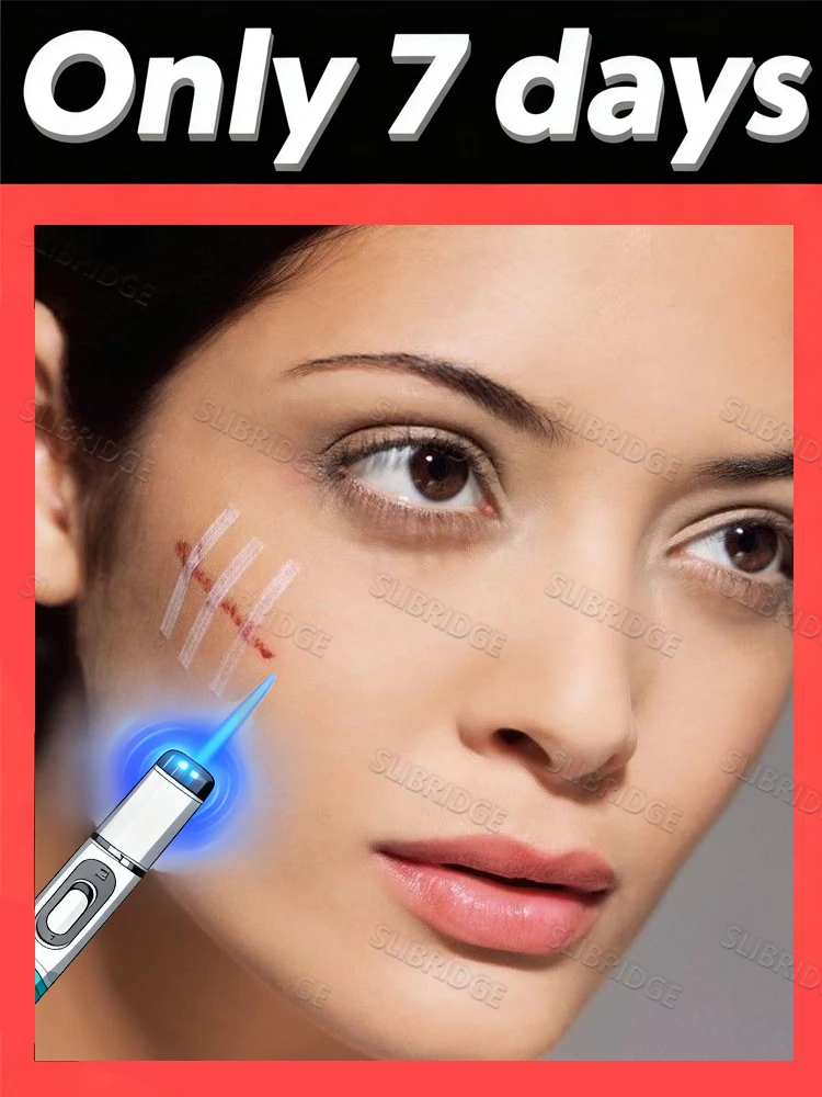 قلم الضوء الأزرق يقول وداعاً لجميع الندبات خلال 7 أيام