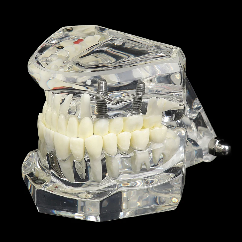 1PCS Cheap Standard Dental Model Teeth Teaching Model Plastic Teeth Model For Dentist Dental Students Studying Education Display