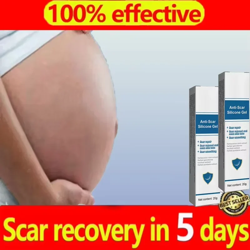 

Cream For Pregnancy Stretch Marks Removal Eliminate Red White Old Stretch Marks Oil