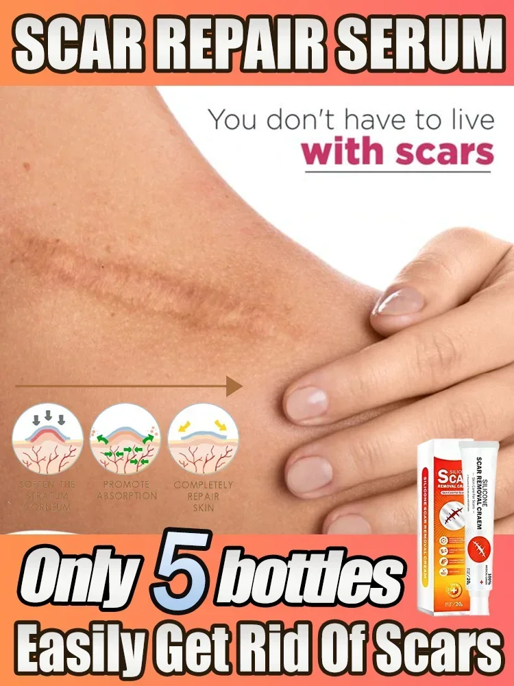 ᴴᴼᵀ Reliable Scar Removal Remove Acne Spots Treatment Stretch Marks Burn Surgical Scar Smoothing Whitening Pigmentation Care