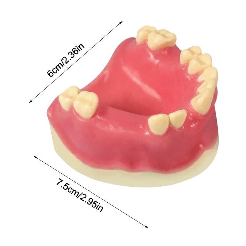 نموذج فقدان الأسنان زرع الأسنان طالب التدريب التدريب المعونة ممارسة نموذج العلوي الفك رفع يزرع استعادة نموذج مختبر