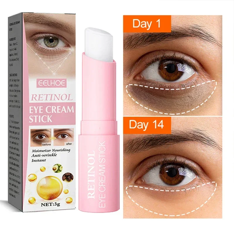 Crème pour les yeux au rétinol, remodelage instantané des yeux, déformable, dissolvant de sacs de vache foncé, anciers hydratant, beauté, santé, cosmétiques coréens