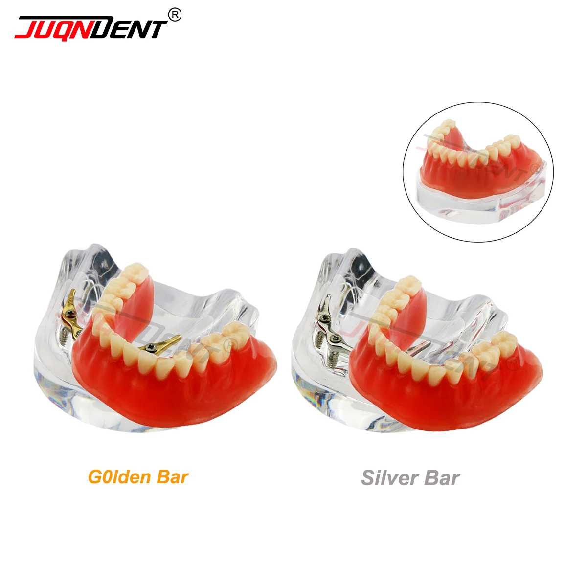 

Зубная съемная модель зубов Overdenture, восстановление верхних и нижних зубов, модель Typodont, защита имплантатов