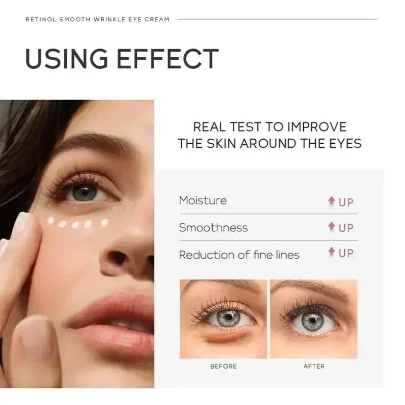 Crème anti-déformable pour les yeux, rétinol, élimine les poches sous les yeux, anti-âge, lifting, raffermissant, blanchissant, hydratant, éclaircissant, soins de la peau