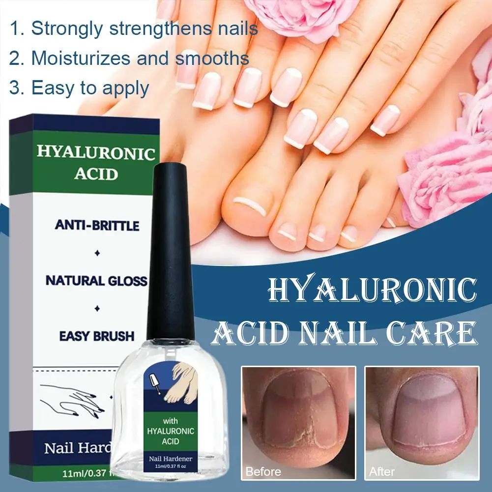 Nail Care  Intense Moisture Treatment For Hydrated, Strong Nails – Reduces Brittle Nails Nail Care Solutiaon 11ml