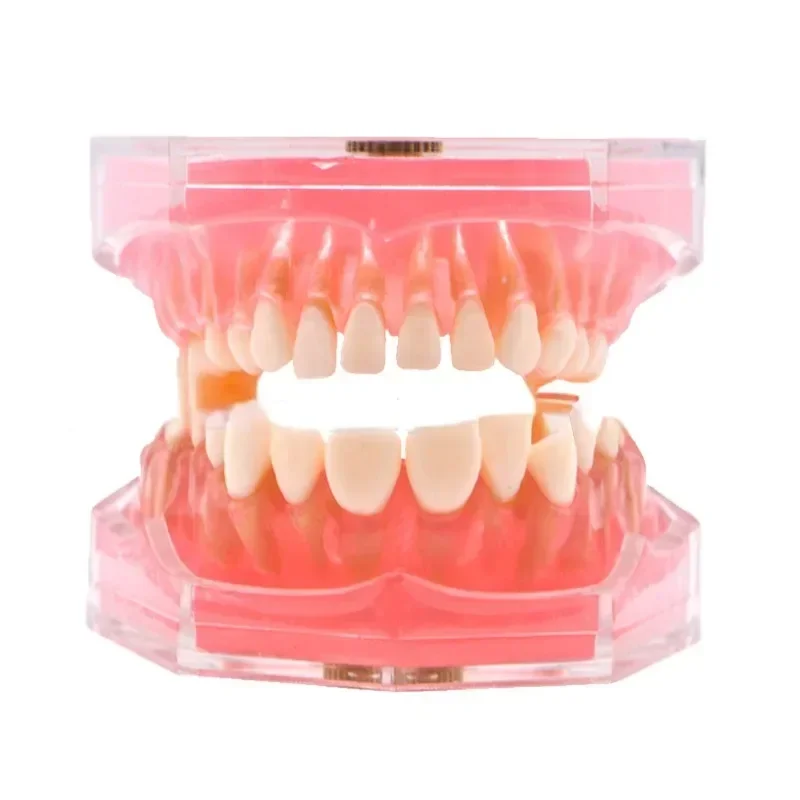 Teeth Dental Soft Support Standard Extractable Tooth Stomatology Typodont Model 1:1 Demo Gum Jaw Removable Dental Teaching Model