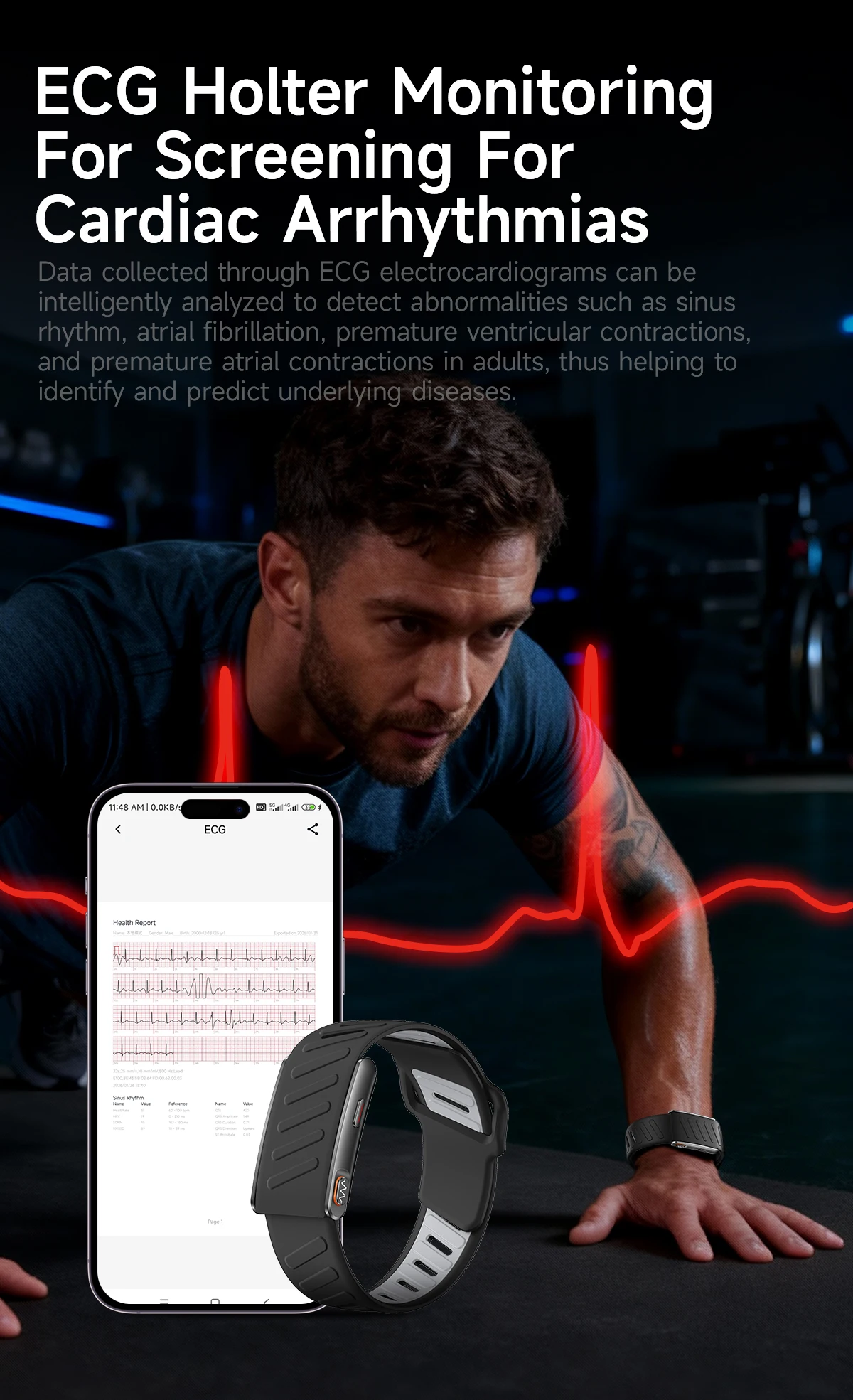 VWAR MG ECG+PPG Nursing Grade Smart Bracelet HRV Body Fat BMI Smart Band Body Temperature Men Women Health Sports Fitness Watch