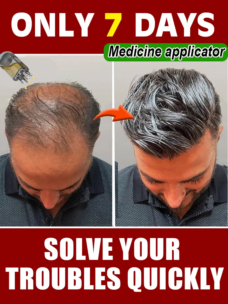 

Scalp Applicator Hair Regrowth & Styling Solution Guide Comb Hexagon Head Oil Roller Ball Massage Comb Massage Relaxation Tools