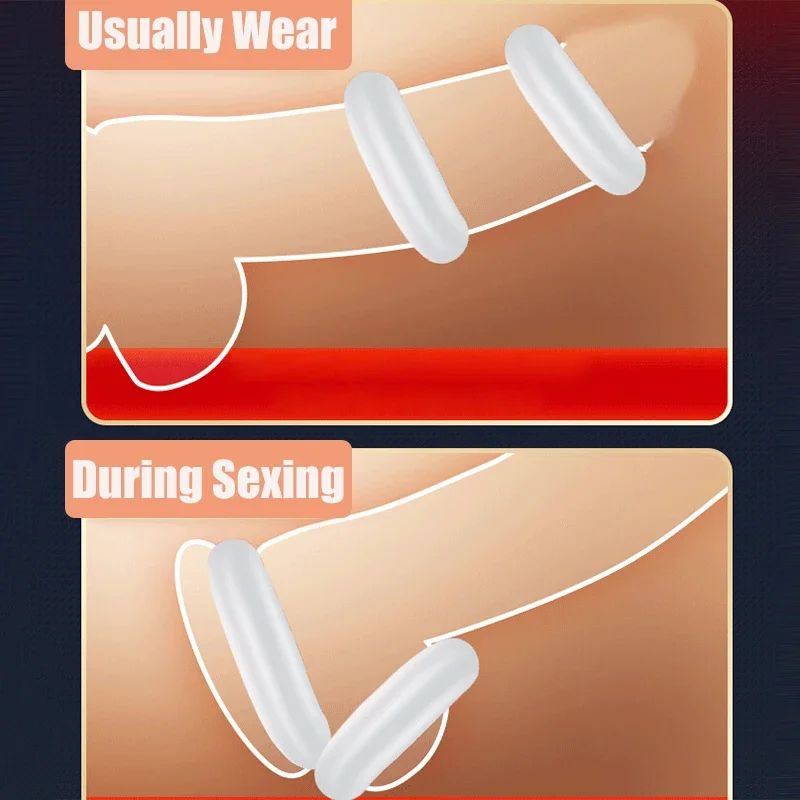 3PCS/Set Male Foreskin Correction Ring Delay Ejaculation Cock Rings Reusable Penis Rings Sex Toys for Men Cockring Chastity Cage