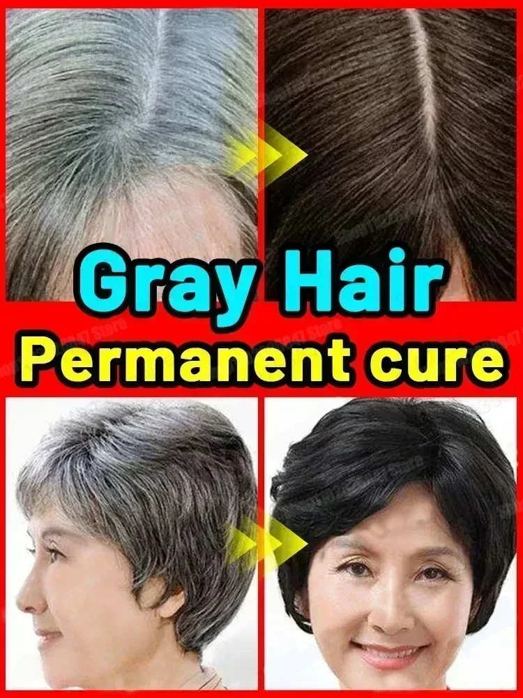 Serum essence Rambut Anti abu-abu, perawatan memulihkan warna rambut alami dan memulihkan rambut putih sehat ke rambut hitam