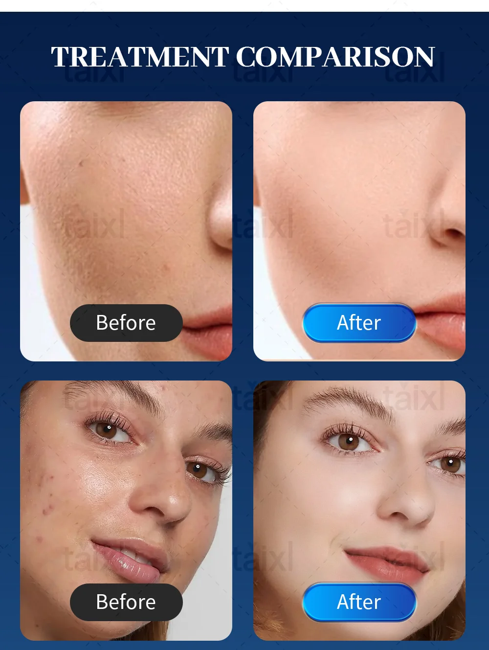 Professional Morpheus 8 RF Microneedling Machine Anti‑Aging Facial Skin Care Beauty Tool With 12 24 40 Nano Pin Cartridge.