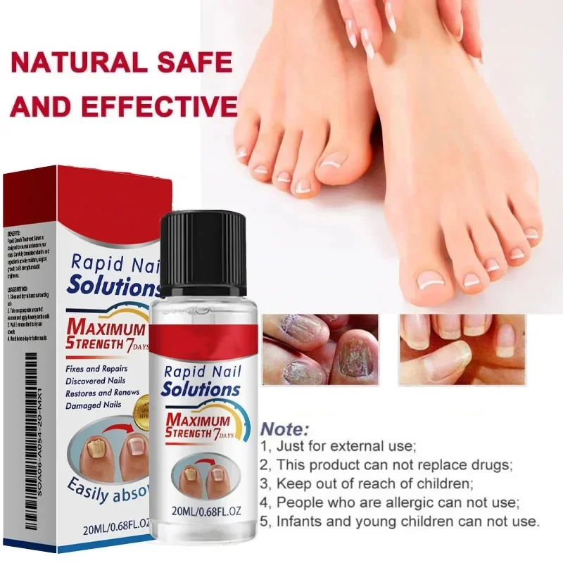 1/2/5 шт. эссенция для ухода за ногтями-жидкость для восстановления пожелтения и утолщения седых ногтей рук и ног увлажняющая жидкость для ногтей 20 мл