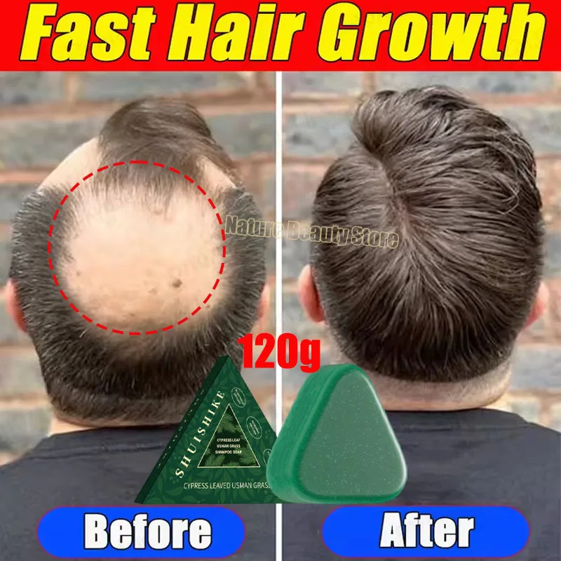 

Fast Ginger Hair Growth Soap Usman Grass Anti Hair Loss Hair Regrowth Serum Scalp Damaged Repair Nourish Care Products Women Men