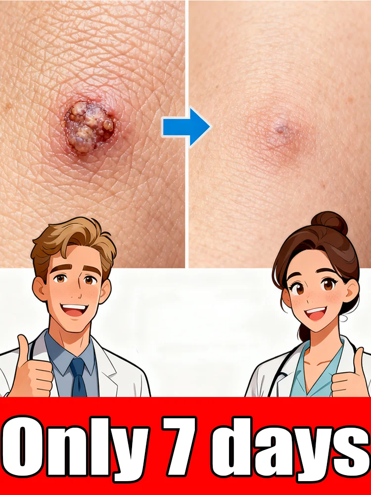 

Hᴏᴛ sᴇʟʟɪɴɢ ʙʟᴜᴇ ʟɪɢʜᴛ ᴘᴇɴ ᴛᴏ sᴏʟᴠᴇ ʙᴏᴅʏ ᴡᴀʀᴛs, ᴡᴀʀᴛ ᴄᴀʀᴇ ᴛᴏᴏʟs