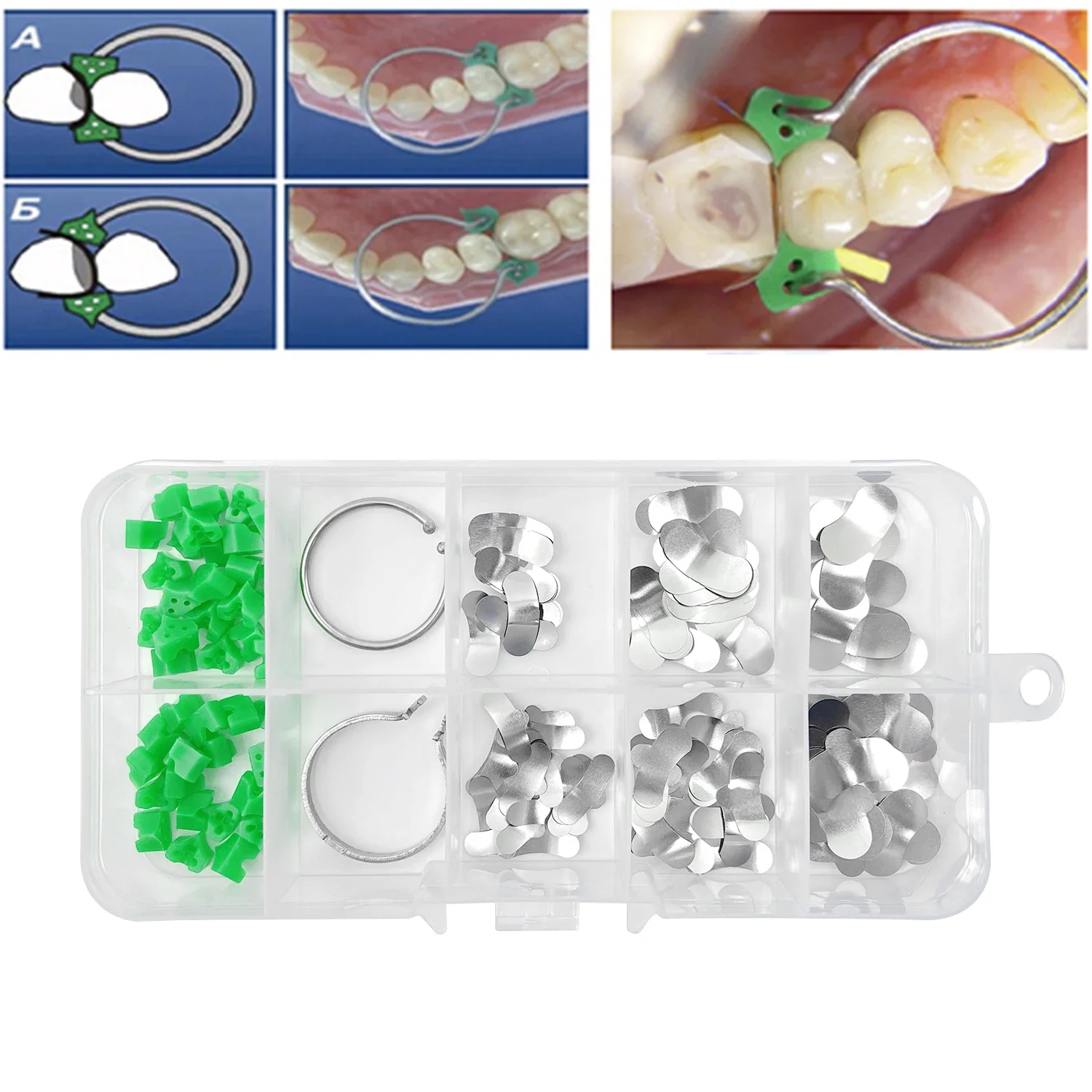 JOLANT Dental Sectional Contoured Matrices Matrix Ring with 40Pcs Delta Wedges Silicon Rubber Elastic Wedges Dentist Tools Lab