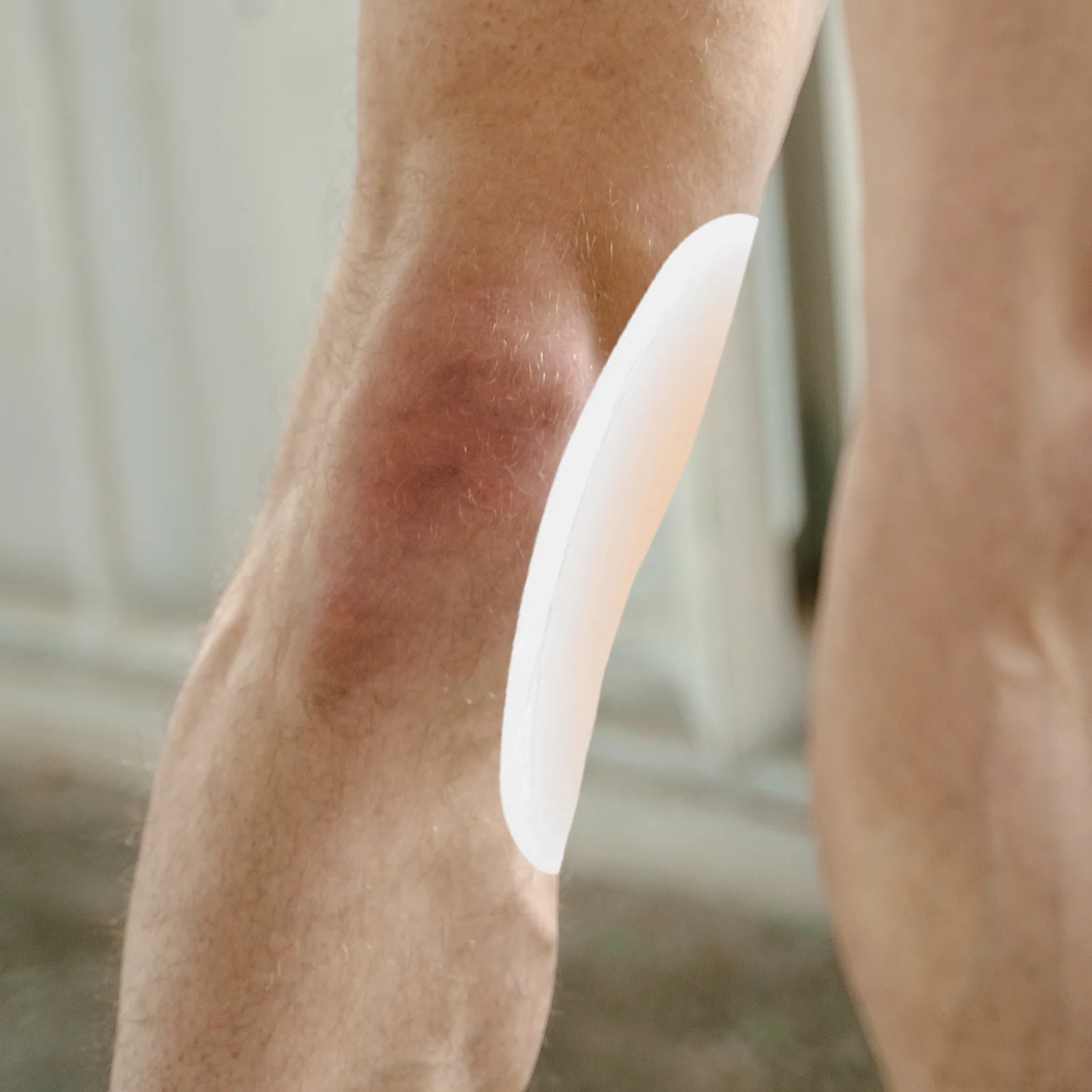 

1 пара корректорных подушечек в форме икры, самоклеящиеся силиконовые корректоры для ног, невидимые патчи для телят тон кожи для женщин