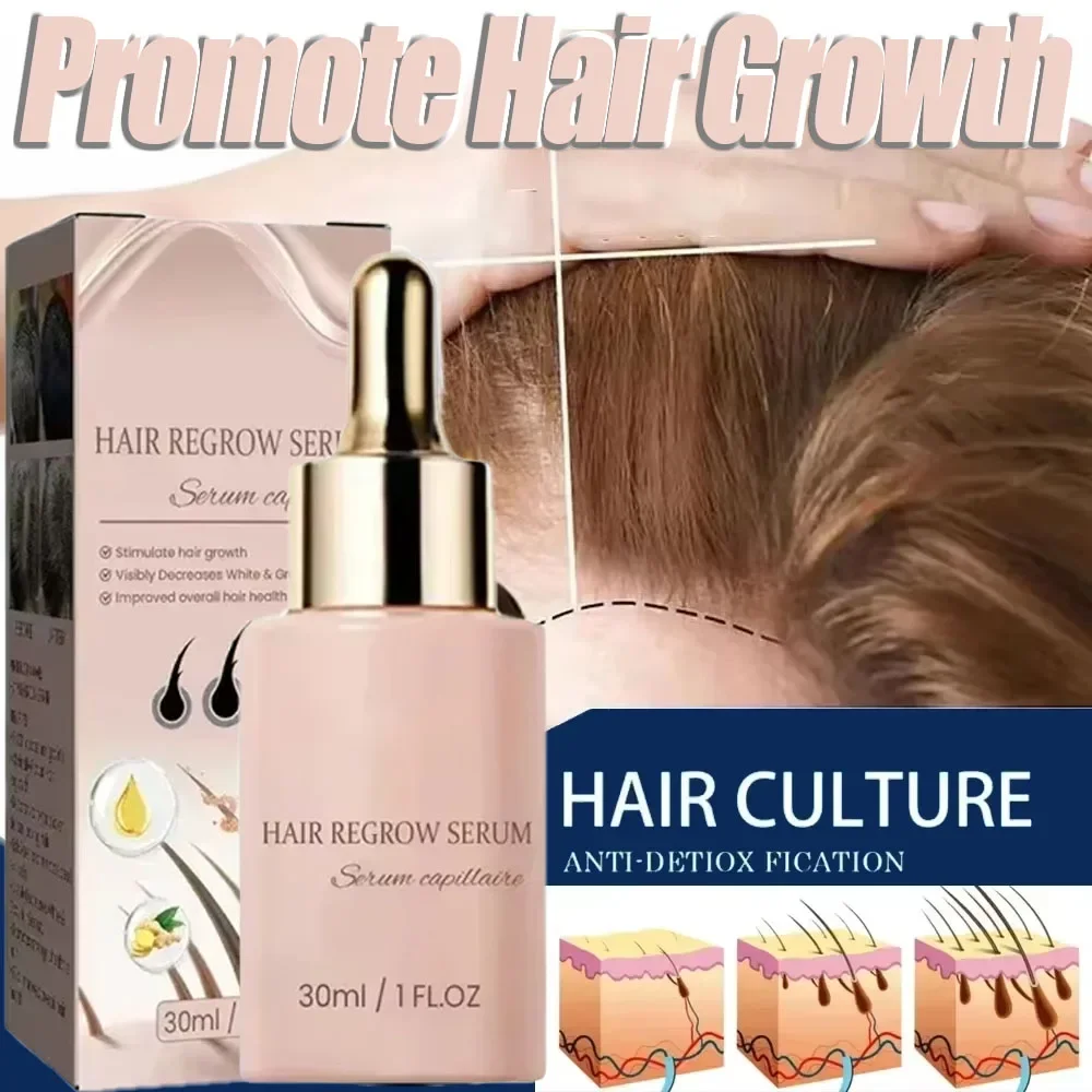 Hair Growth for Men Women Prevent Hair Loss Products Essential Oils Ginger Anti Hair Loss Scalp Treatment Oil