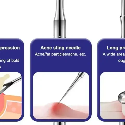 Rimozione di punti neri Brufolo Popper Strumento Acne Ago Rimozione Trattamento Punti bianchi Popping Zit Naso Viso Estrattore di imperfezioni Detergente
