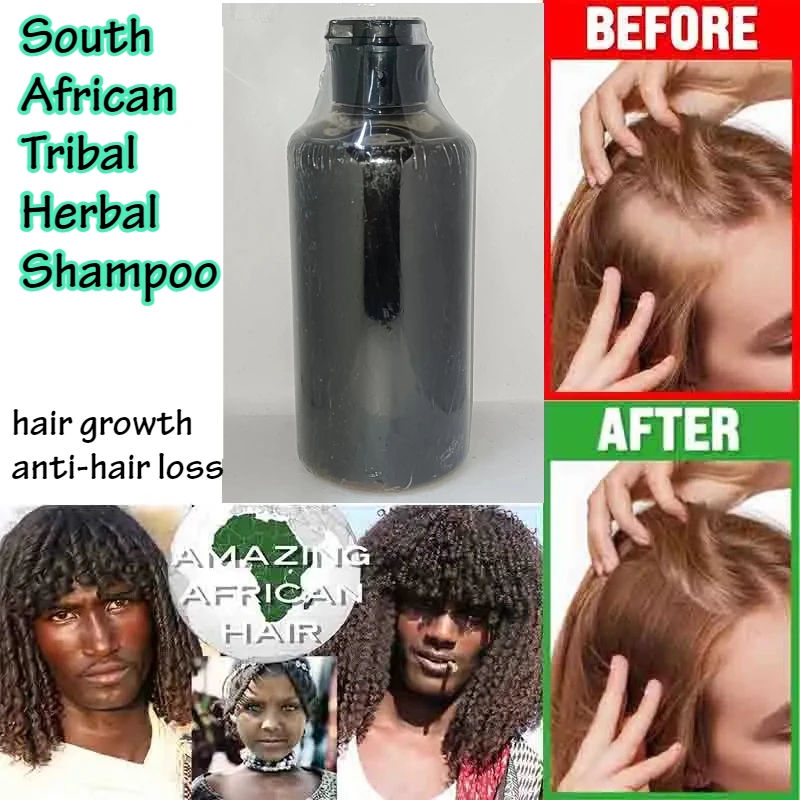 

Южноафриканский племенный травяной шампунь для волос, рост волос, без силиконового контроля жирности, против перхоти, зуда, очищающее средство для лечения волос