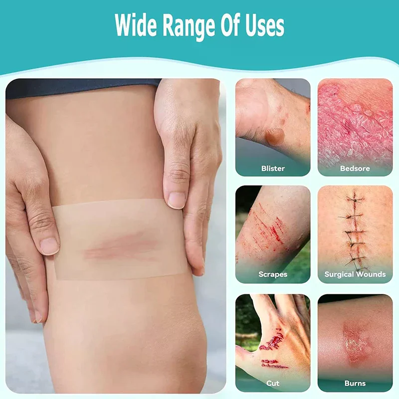 

Highly Absorbent Hydrocolloid Roll For Wound Care Hydrocolloid Patch Bandages With Self-Adhesive, Bed Sore Bandages