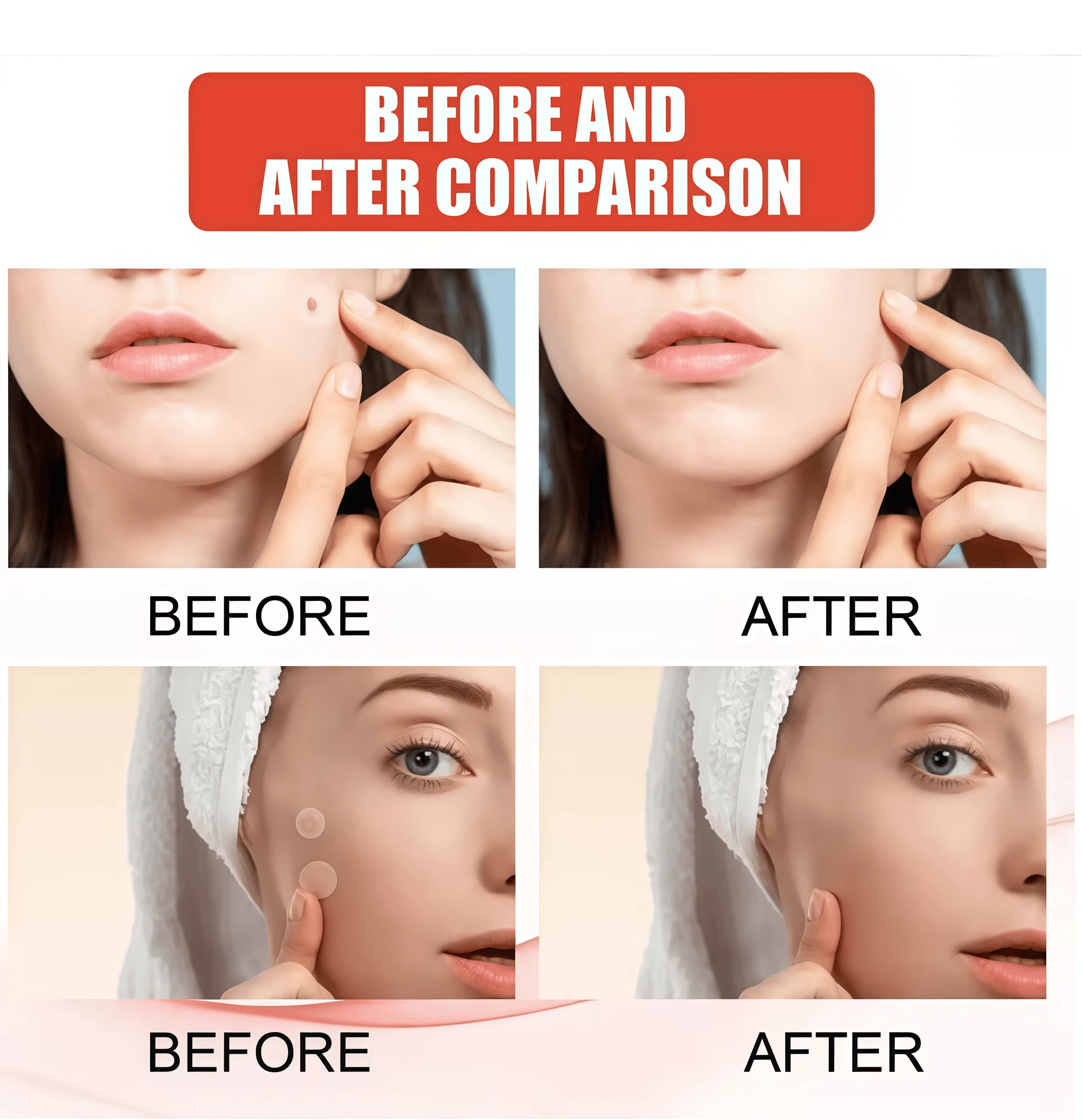 رقع حب الشباب الغروانية المائية غير المرئية - ملصقات العيب والبثور، تثبيت سريع للدراسات، بشرة مهدئة ومهدئة، لطيفة وسهلة